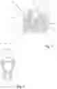 Fig. 04 - Railway car brake lock