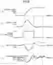 Fig. 09 - Vehicle behavior control device