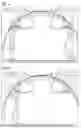 Fig. 04 - Method for installing an interior fitting component of an aircraft, interior fitting component for an aircraft and system for mounting interior fitting components