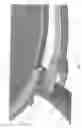 Fig. 08 - Container lid and lock ring combination