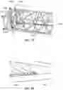 Fig. 16 - Adjustable length tensioning member