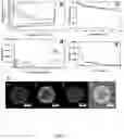 Fig. 07 - Biodegradable hollow nanoparticles and methods and apparatus for manufacturing the same