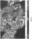 Fig. 05 - Transition metal cyanide coordination compounds having multiple reactions