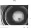 Fig. 04 - Flowing-water sterilization system