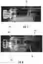 Fig. 06 - Strengthened glass articles with separation features