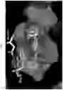 Fig. 02 - Grp94 selective inhibitors and uses thereof