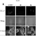 Fig. 04 - Grp94 selective inhibitors and uses thereof
