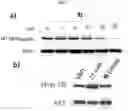 Fig. 07 - Grp94 selective inhibitors and uses thereof