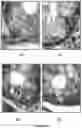 Fig. 17 - Bisaminoquinoline compounds, pharmaceutical compositions prepared therefrom and their use