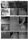 Fig. 04 - IL-1RA cDNAs