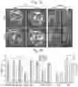 Fig. 08 - IL-1RA cDNAs
