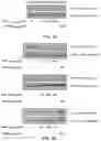 Fig. 03 - Inhibitors of prototypic galectin dimerization and uses thereof