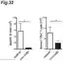 Fig. 33 - PROPHYLACTIC AGENT, ONSET-SUPPRESSING AGENT OR THERAPEUTIC AGENT FOR PROGRESSIVE IMMUNE DEMYELINATING DISEASES