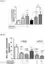 Fig. 03 - Methods for inhibiting atherosclerosis by administering an anti-PCSK9 antibody