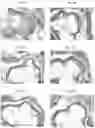 Fig. 04 - Methods for inhibiting atherosclerosis by administering an anti-PCSK9 antibody