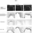 Fig. 08 - Methods for inhibiting atherosclerosis by administering an anti-PCSK9 antibody