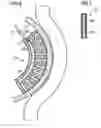 Fig. 06 - Infusion of drugs