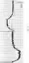 Fig. 16 - INTEGRATED MICROELECTRODES AND METHODS FOR PRODUCING THE SAME