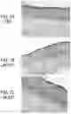 Fig. 13 - Methods for culturing human keratinocytes