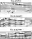 Fig. 14 - Methods for culturing human keratinocytes