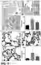 Fig. 04 - COMPOSITION COMPRISING GLYCYRRHIZIN FOR INDUCING DIFFERENTIATION INTO MYELOID-DERIVED SUPPRESSOR CELL FROM MYELOID CELL