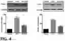 Fig. 05 - COMPOSITION COMPRISING GLYCYRRHIZIN FOR INDUCING DIFFERENTIATION INTO MYELOID-DERIVED SUPPRESSOR CELL FROM MYELOID CELL