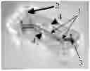 Fig. 01 - Neuromuscular junction
