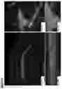 Fig. 19 - Neuromuscular junction