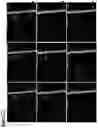 Fig. 28 - Neuromuscular junction