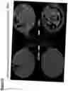 Fig. 30 - Neuromuscular junction