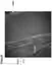 Fig. 31 - Neuromuscular junction