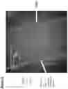 Fig. 32 - Neuromuscular junction