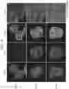 Fig. 09 - In vitro fibrosis model, preparing method therefor, and use thereof