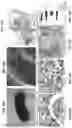 Fig. 16 - Methods for generation of pluripotent and multipotent cells