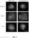Fig. 07 - Method of preparing mimicking angiogenic co-spheroids and application thereof