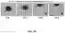 Fig. 12 - Method of preparing mimicking angiogenic co-spheroids and application thereof
