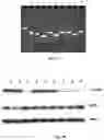 Fig. 04 - Compositions of asymmetric interfering RNA and uses thereof