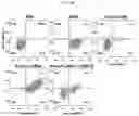 Fig. 06 - Therapeutic agent for treating cancer comprising anti-miRNA-albumin composite