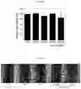 Fig. 08 - Therapeutic agent for treating cancer comprising anti-miRNA-albumin composite