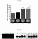 Fig. 11 - Therapeutic agent for treating cancer comprising anti-miRNA-albumin composite
