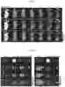 Fig. 12 - Therapeutic agent for treating cancer comprising anti-miRNA-albumin composite
