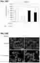 Fig. 16 - COMPOSITION AND METHOD OF USING MIR-302 PRECURSORS AS DRUGS FOR TREATING ALZHEIMER'S DISEASES