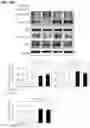 Fig. 18 - COMPOSITION AND METHOD OF USING MIR-302 PRECURSORS AS DRUGS FOR TREATING ALZHEIMER'S DISEASES