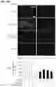 Fig. 22 - COMPOSITION AND METHOD OF USING MIR-302 PRECURSORS AS DRUGS FOR TREATING ALZHEIMER'S DISEASES