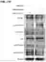 Fig. 30 - COMPOSITION AND METHOD OF USING MIR-302 PRECURSORS AS DRUGS FOR TREATING ALZHEIMER'S DISEASES