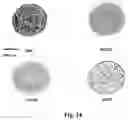Fig. 18 - Method of modulating the number and the distribution of tumor-infiltrating leukocytes in tumors