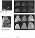 Fig. 18 - SYSTEM AND METHODS FOR THE BIOCONTROL OF PLANT PATHOGENS