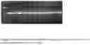 Fig. 04 - Method of diagnosis and treating gastrointestinal and neurological diseases associated with species of genus 