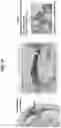Fig. 19 - Biomarker pairs for predicting preterm birth