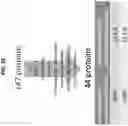 Fig. 30 - Biomarker pairs for predicting preterm birth